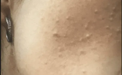 Los efectos del glúten en Tutú Vidaurre.