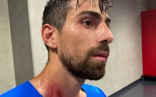 Luan Peres quedó con marcas en el cuello, brazos y espalda.