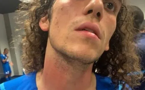 Matteo Guendouzi experimentó lesiones por estrangulamiento.