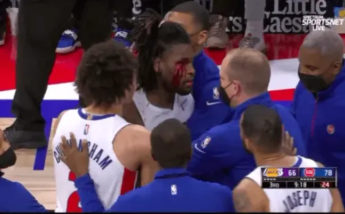 Así quedó el rostro de Isaiah Stewart tras el brutal golpe que le propinó LeBron James y que desató la ira del jugador de los Pistons. (Foto: captura)