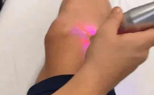 Gary Medel subió un video de tratamiento kinesiológico en su cuenta de Instagram.