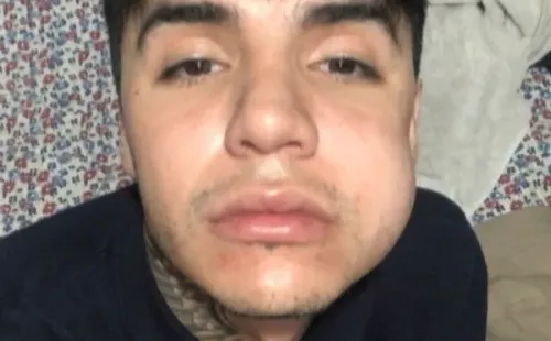Leo Méndez Jr. lanza denuncia contra clínica por fallida bichectomía.(2)