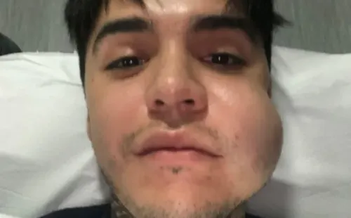 Leo Méndez Jr. lanza denuncia contra clínica por fallida bichectomía.(3)