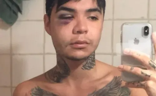 Leo Méndez Jr. lanza denuncia contra clínica por fallida bichectomía.(5)