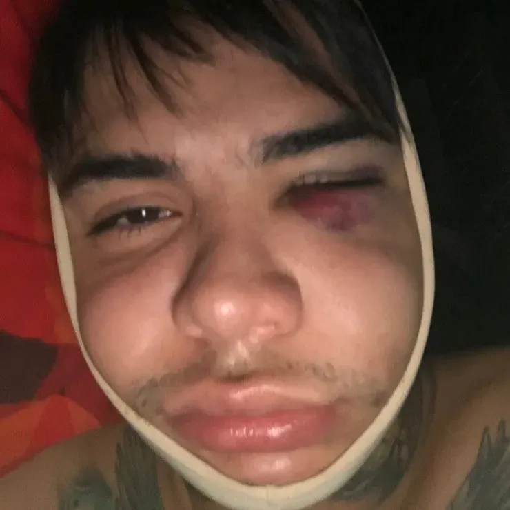 Leo Méndez Jr. lanza denuncia contra clínica por fallida bichectomía.(6)