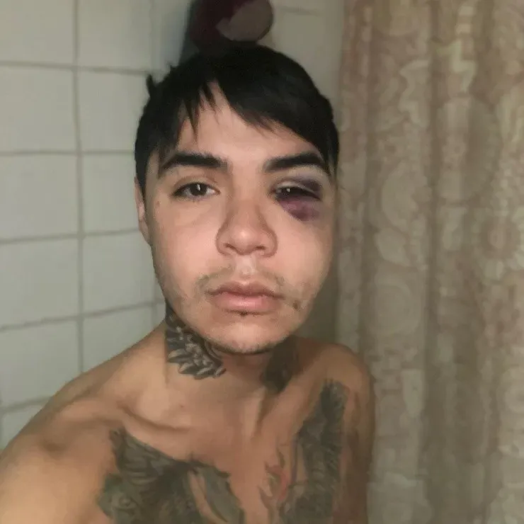 Leo Méndez Jr. lanza denuncia contra clínica por fallida bichectomía.(7)