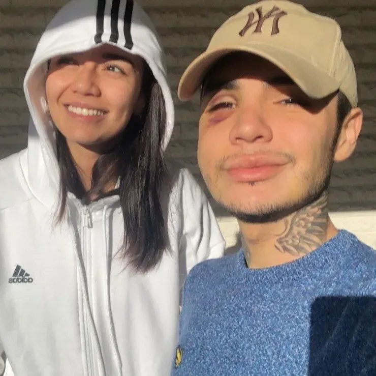 Leo Méndez Jr. lanza denuncia contra clínica por fallida bichectomía.(8)