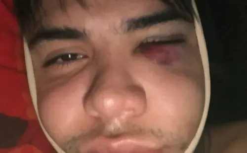 Clínica estética reacciona ante feroz denuncia de Leo Méndez Jr.