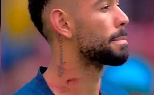 Así le quedó el cuello al jugador brasileño