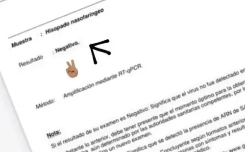 Alexis compartió su PCR negativo a través de las redes sociales. (Foto: @alexis_officia1)