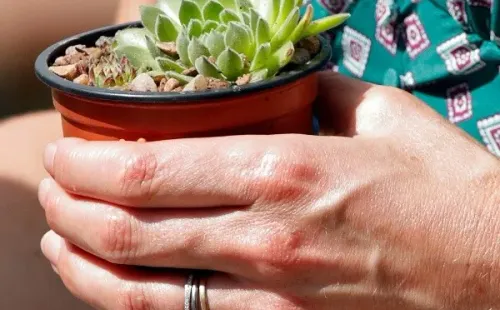Planta | Foto: Getty Images