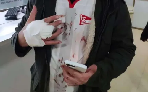 Hincha de Estudiantes herido tras la bengala lanzada por la parcialidad uruguaya (Foto: Instagramsomosedlp)