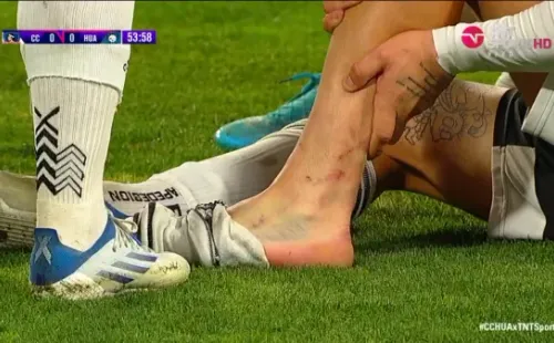 Así quedó el pie de Maxi Falcón. | Foto: TNT