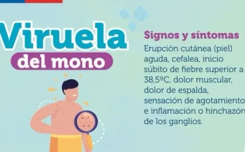 Síntomas Viruela del Mono | Ministerio de Salud