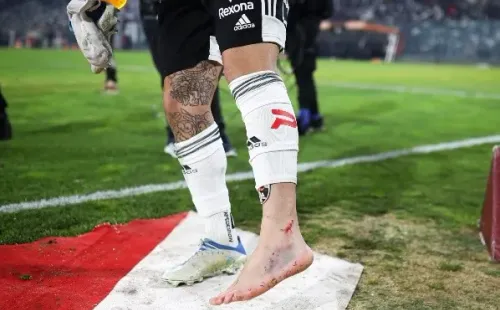 Maximiliano Falcón sufrió un duro golpe ante Huachipato. (Foto: Agencia Uno)