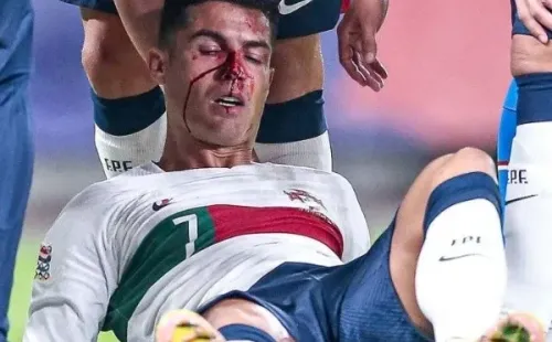 Cristiano Ronaldo casi nocaut en el duelo de Portugal contra República Checa. (Foto: gentileza)