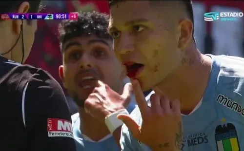 Así le quedó la boca a Diego González tras el choque con Mathias Pinto que terminó en su expulsión (Captura TNT Sports).