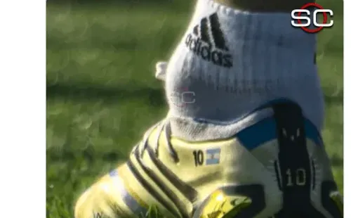 Así se vio el tobillo de Lionel Messi.