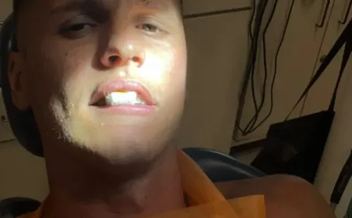 Guido Carrillo recibió tratamiento dental de madrugada. (Captura Instagram).