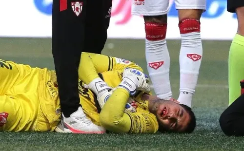 ¡Fuerza y pronta recuperación para Nelson Espinoza! (Jonathan Oyarzún/Photosport)