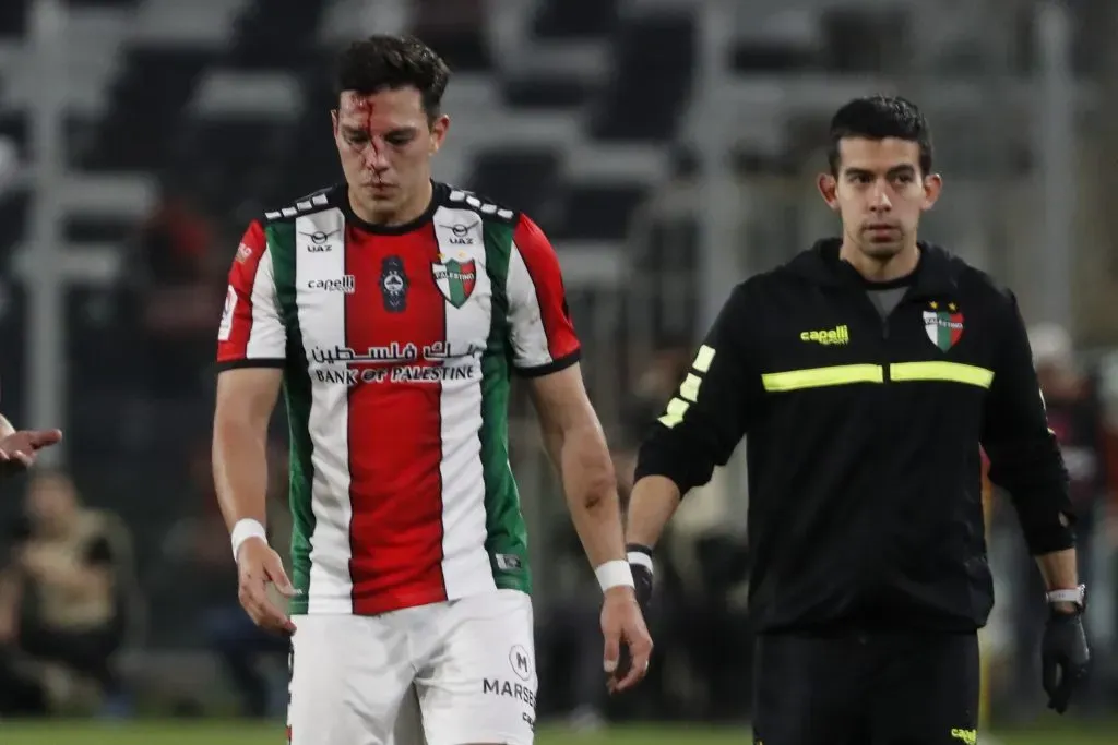 Así quedó Fernando Meza tras el golpe de Jeyson Rojas. El “2” de Palestino fue reemplazado en el entretiempo. (Marcelo Hernández/Photosport).