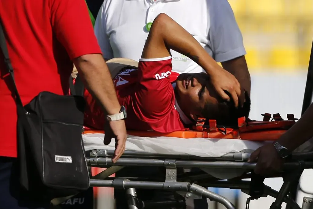 Así salió Jovany Campusano tras la fractura que sufrió por una trabada con Fernando Saavedra. (Andrés Piña/Photosport).