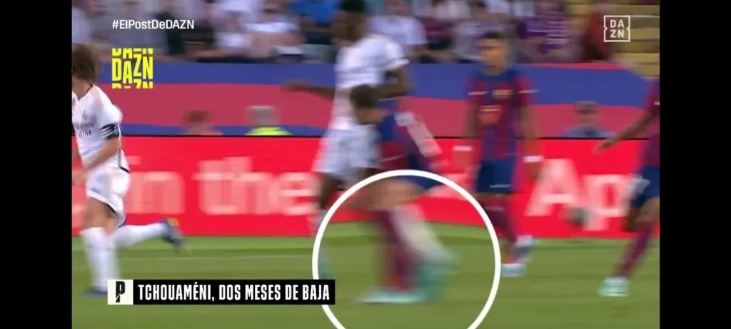La imagen que desmintió Tchouaméni sobre su lesión. (Captura DAZN).