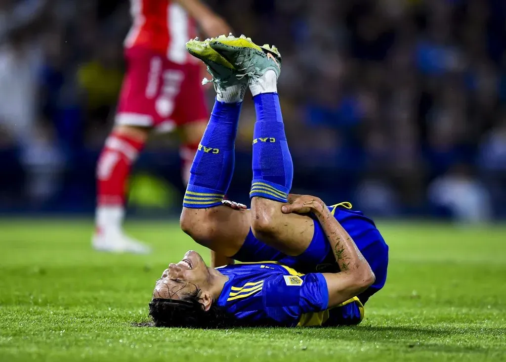 Así quedó Edinson Cavani tras la patada de Franco Calderón. (Marcelo Endelli/Getty Images)