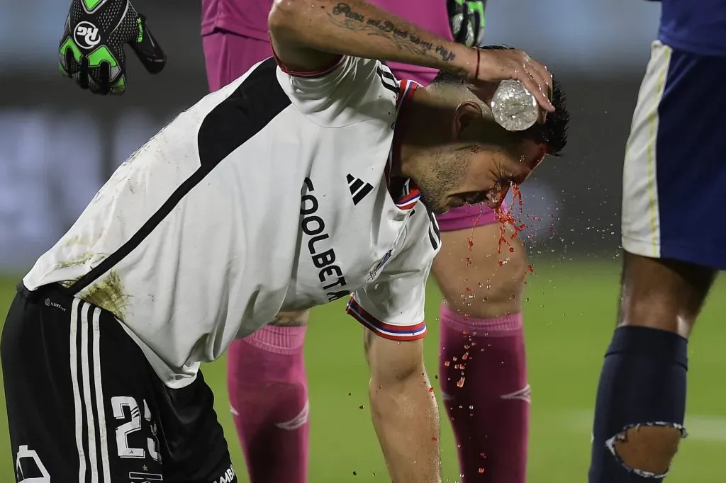 Ramiro González tuvo un accidentado regreso a las canchas | Photosport
