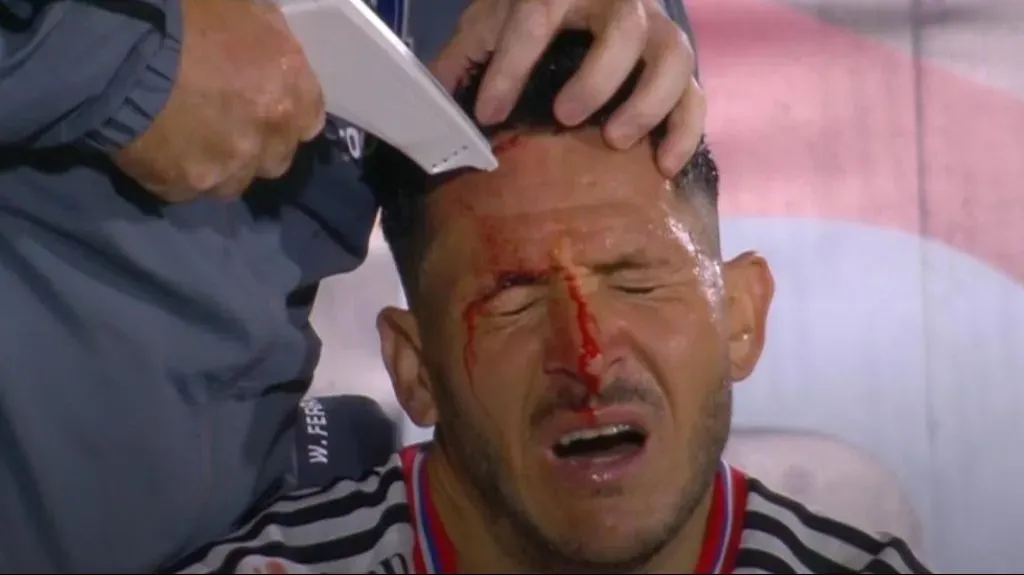 Ramiro González sólo pudo jugar cinco minutos tras sufrir un grave corte en su frente. Foto: ESPN.