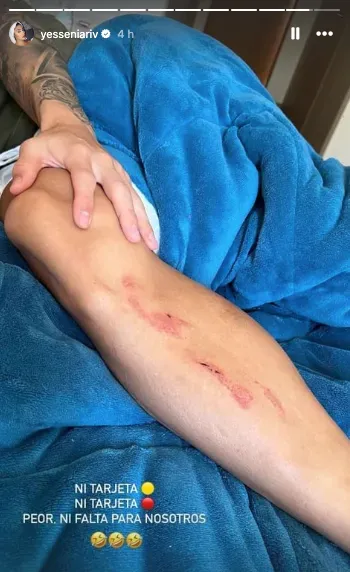 Así quedó la pierna de Guillermo Paiva tras la victoria contra Sportivo Trinidense