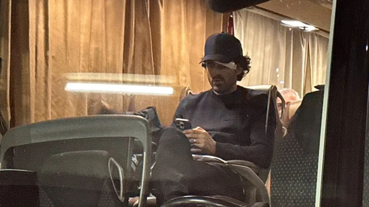 Fabio Grosso needed bandages on his head after rocks broke the windows of the Lyon bus.