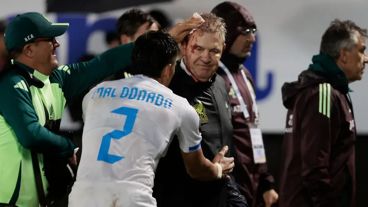 Javier Aguirre, Head Coach of Mexico, leaves the pitch with a head injury due to a bottle thrown by Honduras' fans during the CONCACAF Nations League match between Honduras and Mexico at General Francisco Morazan Stadium on November 15, 2024 in San Pedro Sula, Honduras.